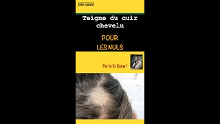 Teigne du cuir chevelu pour les nuls [upl. by Ramhaj]