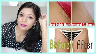 How to remove BIKINI AREA UNWANTED Hair HAIR REMOVAL METHODS  SuperPrincessjo [upl. by Rudwik804]