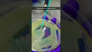 Oxidase test for coliform 🧫🧪🧫microbiologist microbiology bacteria virus fungi microbs [upl. by Ameekahs]