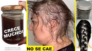 EL CABELLO DEJA DE CAERSE Y CRECE MUCHO CON ESTE CHAMPÚ ORGANICO Y NATURAL🌿100 Efectivo [upl. by Wendin938]