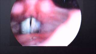 My Vocal Folds 2014 [upl. by Eed]