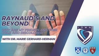 Raynaud’s and Beyond Why are my fingers and toes cold and discolored With Dr Marie GerhardHerman [upl. by Gyasi802]