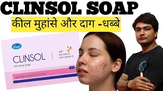 clinsol soap  clinsol soap review in hindi  clinsol soap review  clinsol soap ke fayde [upl. by Ettore]