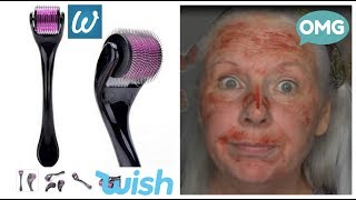 How NOT To Use A Derma Roller Graphic Please read description [upl. by Edelstein]