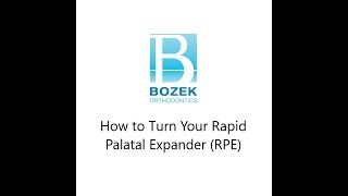 How to Turn Your Rapid Palatal Expander RPE [upl. by Ruyam]