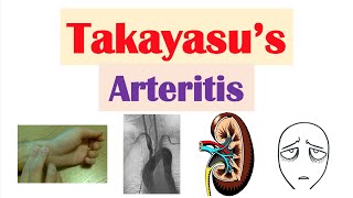 Takayasu’s Arteritis Pulseless Disease  Large Vessel Vasculitis Symptoms Diagnosis Treatment [upl. by Nabal]