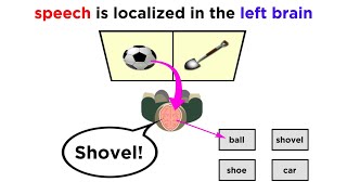 Brain Lateralization The Split Brain [upl. by Joanie]