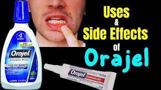 Orajel – Side Effects Uses Mechanism of Action Dosage Interactions Warnings [upl. by Seafowl]