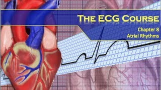 The ECG Course  Atrial Rhythms [upl. by Gert950]