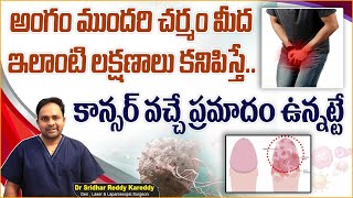 అంగం ముందరి చర్మం మంటగా ఉందా  Balanitis and Balanoposthitis Symptoms in Telugu  TRH [upl. by Siryt404]