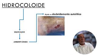 HIDROCOLOIDE Parte 2 [upl. by Sarena]