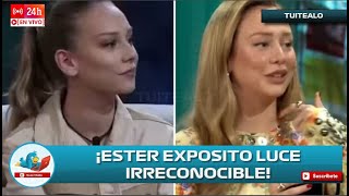 Ester Expósito luce irreconocible tras procedimientos estéticos en la cara y la tunden en redes [upl. by Rasure]