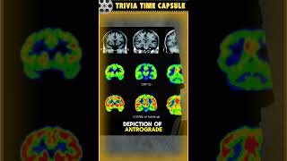 Why Is The Memento Movie PRAISED By Medical Professionals 😲 momento trivia medical [upl. by Assetal]