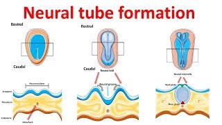 neural tube formation  Embryology  Neurulation [upl. by Ignace]