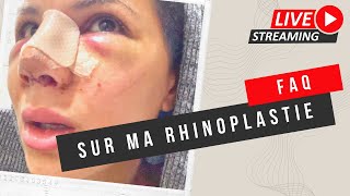 FAQ RHINOPLASTIE EN TURQUIE [upl. by Ominorej]