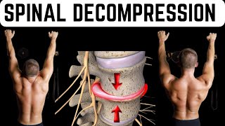 Spinal Decompression Exercise for Sciatica and Back Pain [upl. by Nial]