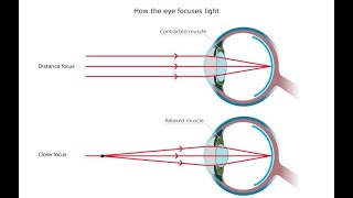 Accommodation amp eye defects grade 12 life sciences  ThunderEDUC  MSAIDI [upl. by Isoj407]