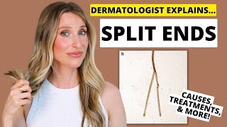 Split Ends Dermatologist Explains Damaged Hair Causes Treatments Prevention amp More [upl. by Scheers]