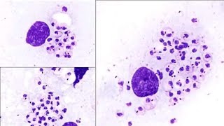 Ciclo de vida de la leishmaniasis [upl. by Hegarty716]