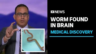 Surgeons pull an 8cm worm from womans brain in Canberra  ABC News [upl. by Rainwater]