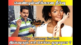 vitiligo treatment in trichy best vitiligo treatment in tamilnadu vitiligo cream vitiligo tattoo [upl. by Cristian]