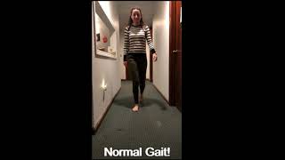 Antalgic Gait Demonstration [upl. by Peyter]