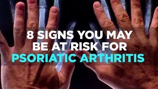 8 Signs You May be at Risk for Psoriatic Arthritis [upl. by Slen]