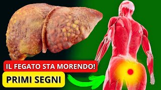 IL FEGATO sta MORENDO 12 strani segni di danno al fegato [upl. by Eelyrag]