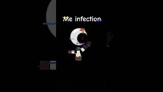 Me infection [upl. by Syhr]