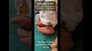 Babinski Reflex in newborn [upl. by Rases]