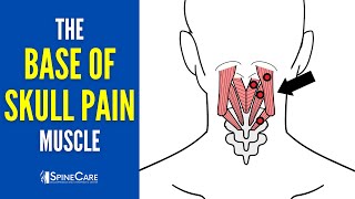 The Base of the Skull Pain Muscle How to Release It for INSTANT RELIEF [upl. by Adamson147]