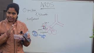 Neonatal Respiratory Distress Syndrome  NRDS Transient Tachypnea of Newborn TTN [upl. by Senalda]