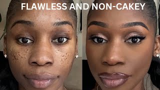 PITTED ACNE SCAR MAKEUP TUTORIAL STEP BY STEP ICEPICK SCARSBOXCAR SCARSCRATERS [upl. by Kienan492]