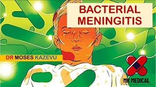 Bacterial Meningitis [upl. by Erlene786]