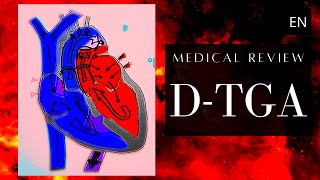 DTransposition of the Great Arteries Congenital Heart Disease [upl. by Htur244]