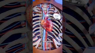 Pacemaker pacemaker heart cardiology heartattack shorts medical nursing viralvideo stunt [upl. by Eihpos]