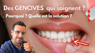 Explication GENCIVE qui SAIGNE  la solution [upl. by Akkinahs]