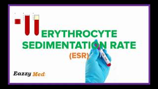 Erythrocyte Sedimentation Rate ESR Made Simple [upl. by Oilenroc]