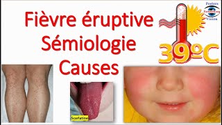 Fièvre éruptive Sémiologie Éruption erythemato maculo papuleuse vésiculeuse purpura Toxidermie [upl. by Hayotal]