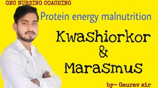 Protein energy malnutrition kwashiorkor and marasmus [upl. by Eanaj]