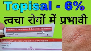 Topisal  6 Uses in Hindi  Clobetasol Propionate and Salicylic Acid Ointment [upl. by Kcyrred]