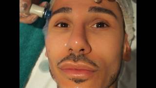 HydraFacial treatment Procedure London before amp after with Danny Defreitas amp London Premier Laser [upl. by Asillim]