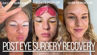 Recovery Post Eye Surgery [upl. by Nysila848]