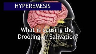 Hyperemesis What causes the Excessive Salivation  Antai Hospital [upl. by Narod20]