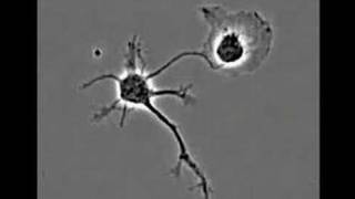 A normal neuron and a mutated neuron develop side by side [upl. by Dorej]