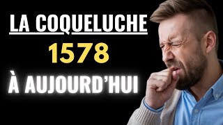 LA COQUELUCHE À TRAVERS L’HISTOIRE DES GRANDES ÉPIDÉMIES À AUJOURD’HUI [upl. by Nedda100]