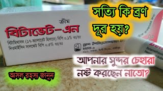 Betavate N Cream Bangla Review  বিটাভেট এন ক্রীম বাংলা রিভিউ  ব্রণ কি দূর হয় [upl. by Eelyme]