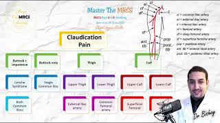 MRCS Shots Claudication Pain Occlusion Sites [upl. by Iznyl]