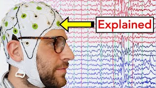 EEG Electroencephalogram Explained [upl. by Keryt]