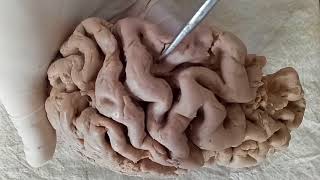 NEUROANATOMY  CEREBRAL CORTEX PART1 SULCI AND GYRI  BY DR MITESH DAVE [upl. by Rehpotsyrhc908]